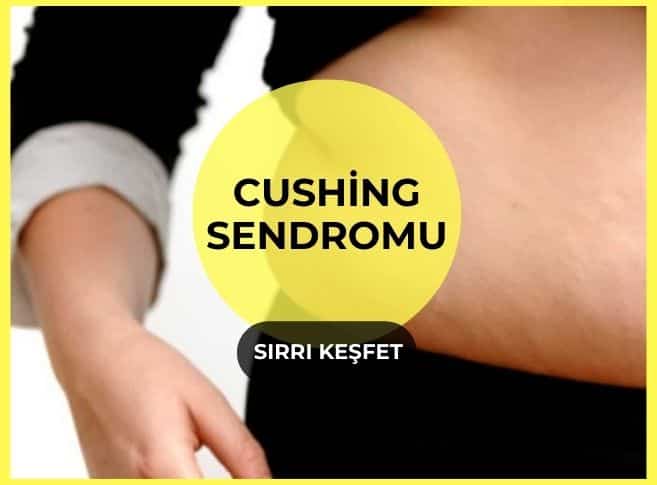 Cushing Sendromu Tedavisi Çözümleri Diyetisyen Tuğba Yaprak