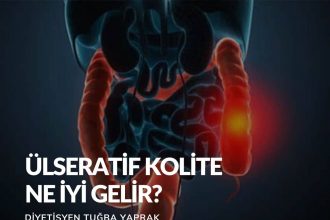 Ülseratif Kolite Ne İyi Gelir?